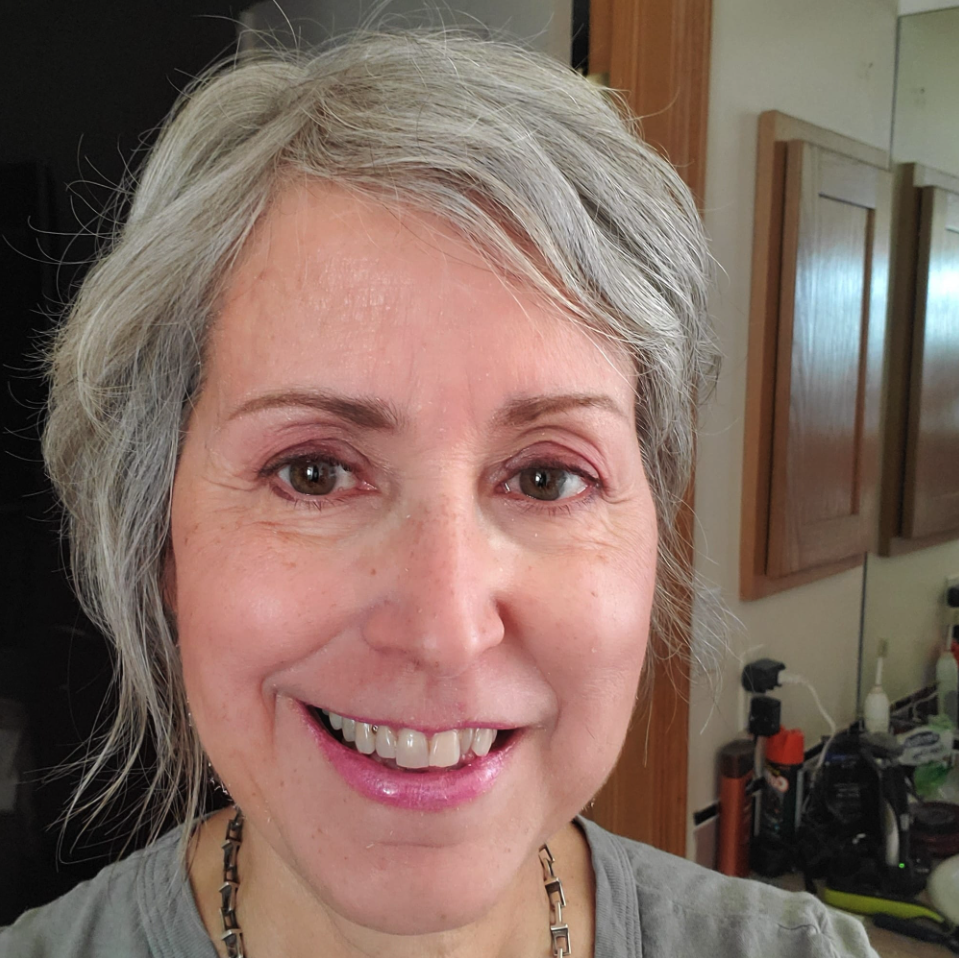 kyphosis posture correction success story Santa Fe