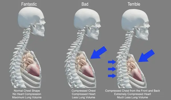 Heart Health and Body Structure