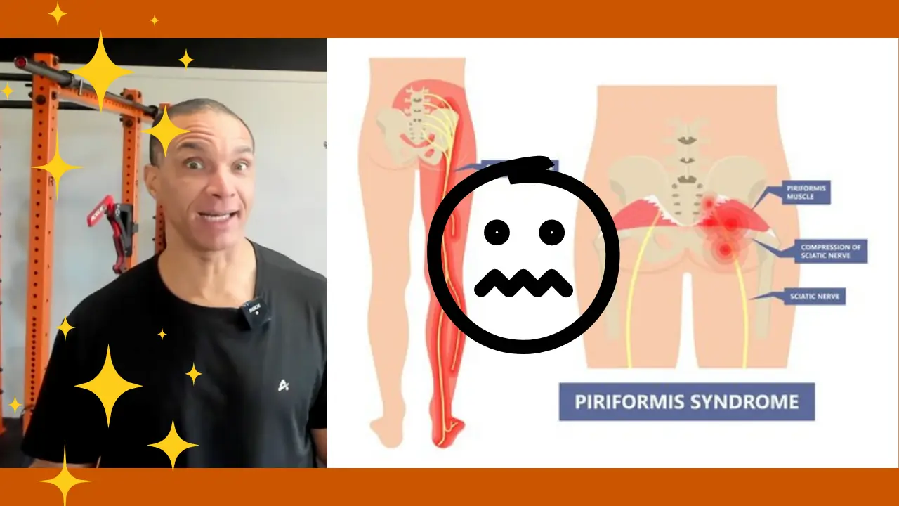 Diagram showing piriformis muscle and sciatic nerve path